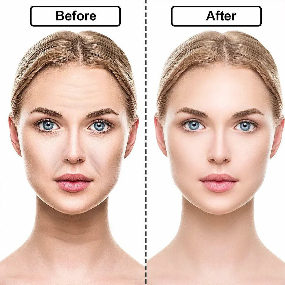 ✨Silicone Anti-Wrinkle Patches – Look 10 to 20 Years Younger Instantly! ✨