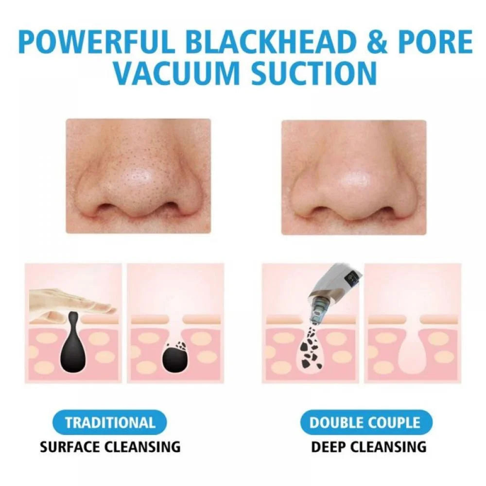 π Electric Blackhead Remover β Instantly Clear Your Skin! π