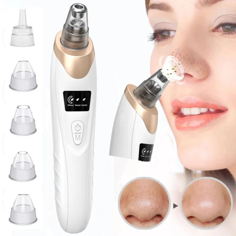 π Electric Blackhead Remover β Instantly Clear Your Skin! π
