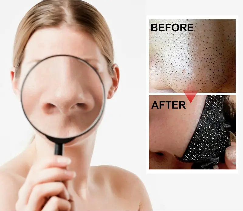 DeepClean Blackhead Remover Strips (20pcs)