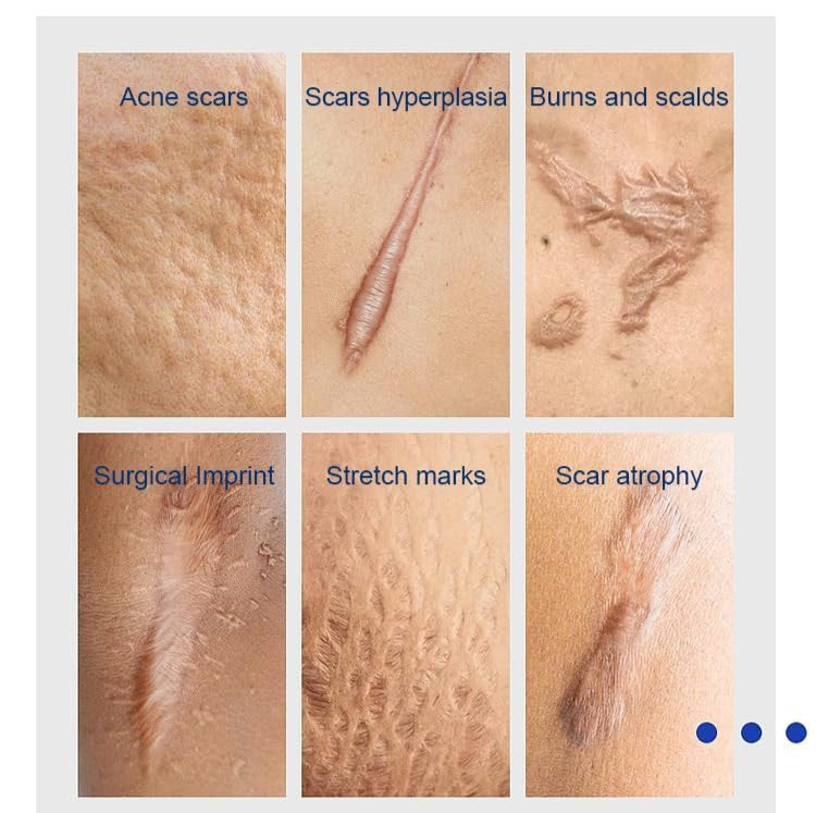 β¨ Scar Removal Cream β Advanced Repair for Flawless Skin! β¨