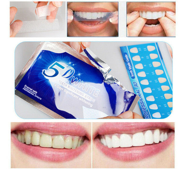✨ 5D Gel Teeth Whitening Strips – Instantly Brighter, Whiter Teeth! ✨