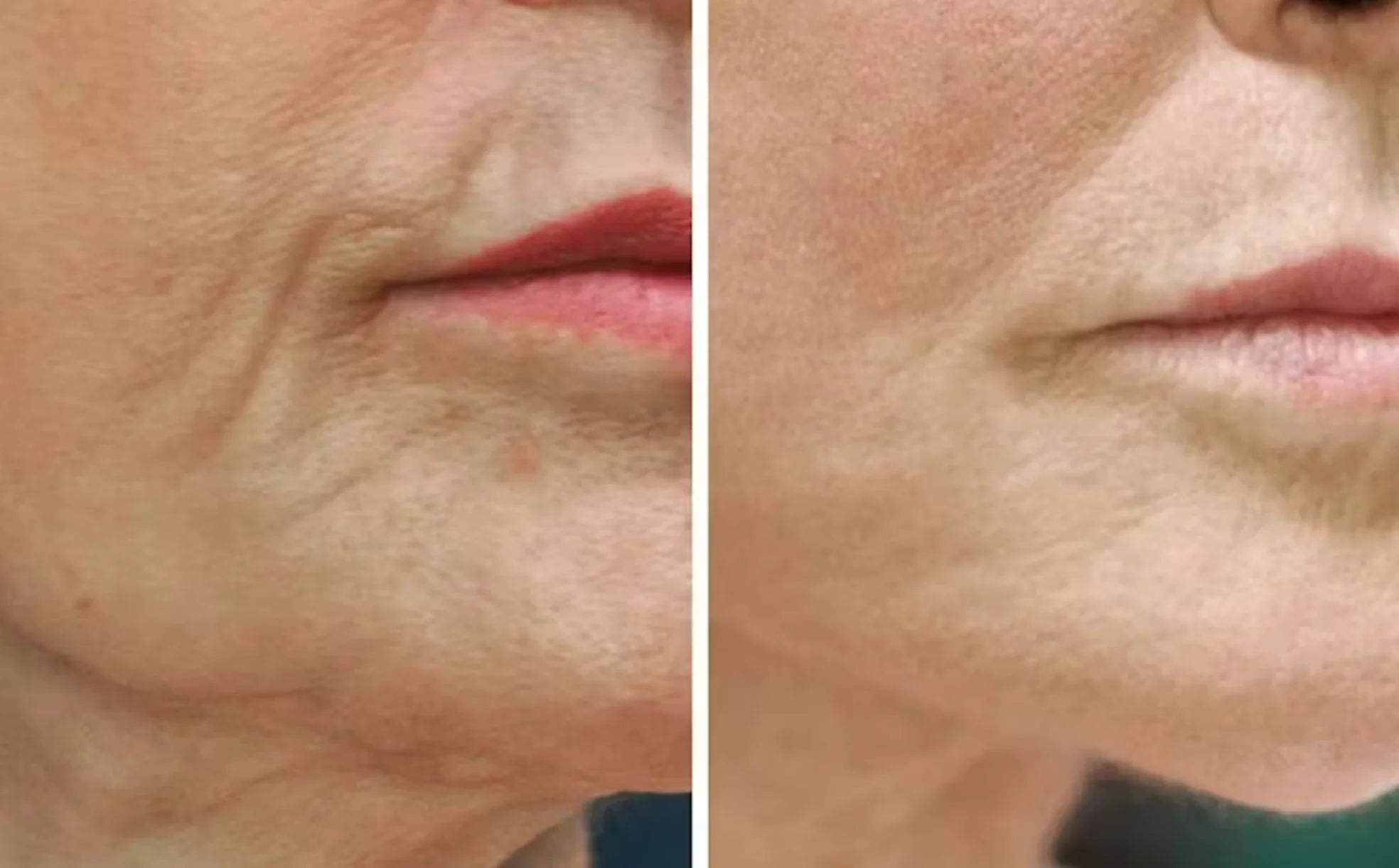 β¨ Face Night Mask β Collagen Wrapping Mask for Firmer, Hydrated, and Youthful Skin β¨