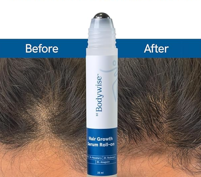 💥 GrowRush™ – Hair Growth Rolling Serum (With Herbal Extracts)