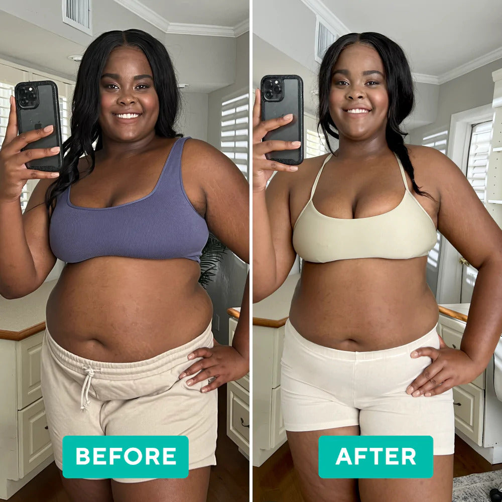 VItalSmyle CelAway™ | Say goodbye to fat and cellulite!
