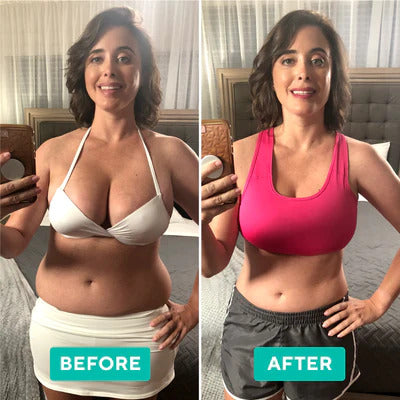 VItalSmyle CelAway™ | Say goodbye to fat and cellulite!