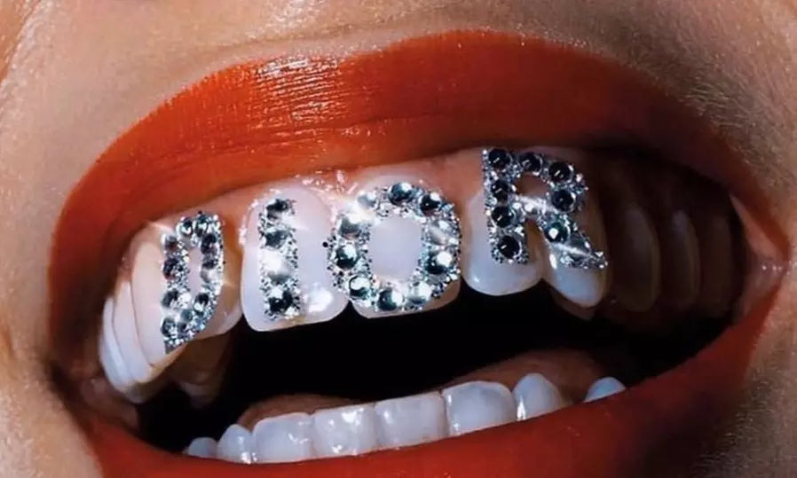 💎 THE ULTIMATE TOOTH GEM KIT – ADD SPARKLE TO YOUR SMILE! 💎