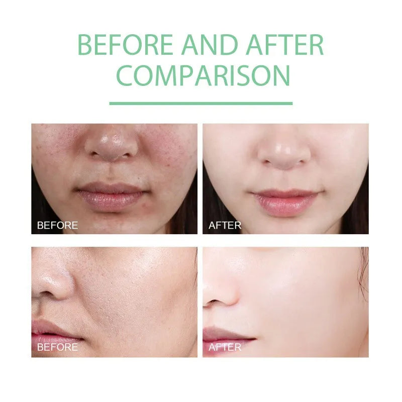 ✨ Reveal Radiant Skin with DeepClean™ Exfoliating Gel – Official Formula (2pcs)